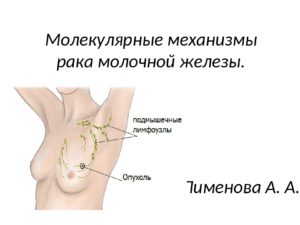 Лимфоузлы под мышками расположение схема у женщин причины возникновения и лечение у женщин