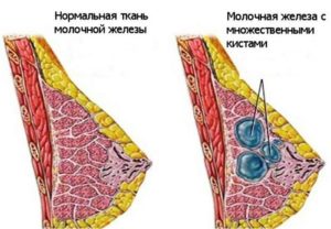 Железистая ткань молочной железы