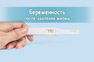 Беременность после удаления миомы