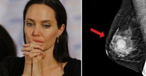 Анджелина джоли рак молочной железы