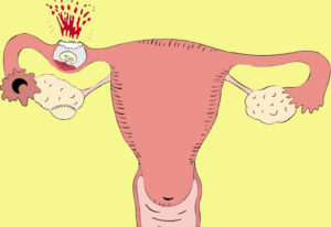 Что происходит во время беременности с яичниками