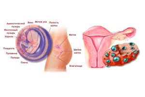 Поликистозные яичники и беременность