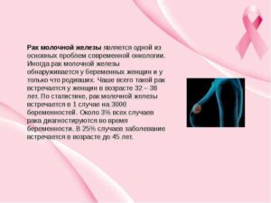 Лактация и рак молочной железы