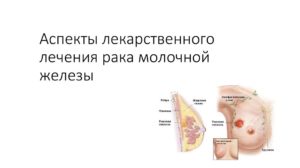 Народные средства лечения рака молочной железы