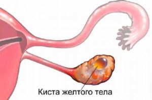 В яичниках образуются