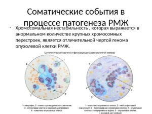 Патогенез рака молочной железы