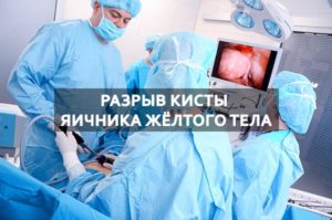 Разрыв желтого тела яичника