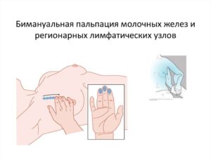 Алгоритм осмотр и пальпация молочных желез