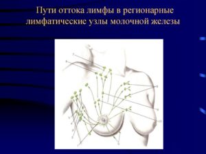 Регионарные лимфатические узлы молочной железы