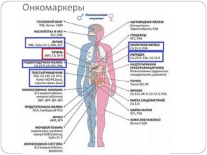 Онкомаркеры яичников и матки