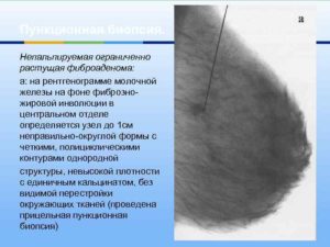 Фиброзно жировая инволюция молочных желез что это
