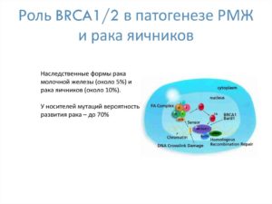 Патогенез рака молочной железы