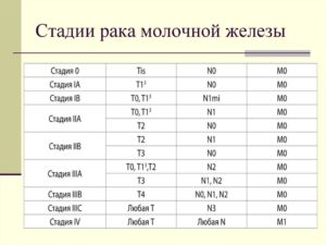 Стадии рака молочной железы классификация