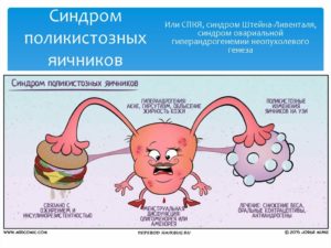 Синдром поликистозных яичников клинические рекомендации