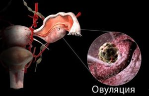 Может ли болеть яичник во время овуляции