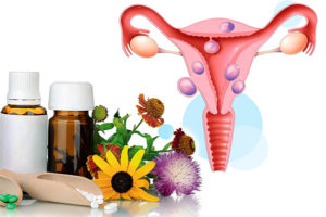 Лечение гомеопатией миомы матки