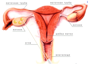 Придатки и яичники это одно и тоже или нет
