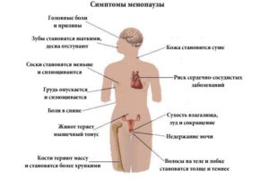 Начало климакса какие признаки