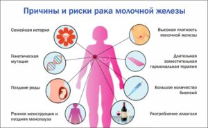 Рак молочной железы причины возникновения