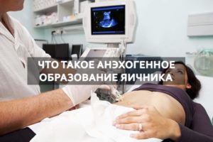 Анэхогенное образование в яичнике что это такое