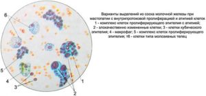 Анализ выделений молочных желез