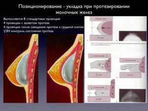 В какой период делают маммографию молочных желез