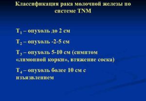 Классификация рака молочной железы