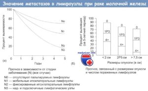 Метастазы в лимфоузлах при раке молочной железы прогноз