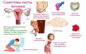 Как болит яичник справа симптомы