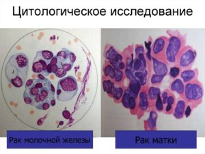 Анализ выделений молочных желез