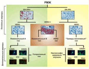 Люминальный а тип рака молочной железы