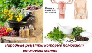 Лечение миомы народными средствами рецепты