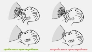 Как правильно разминать молочные железы при застое