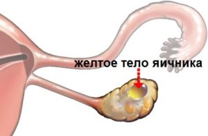 Желтое тело в яичнике и задержка