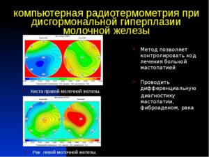 Радиотермометрия молочных желез где сделать