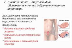 Болит правый яичник причины