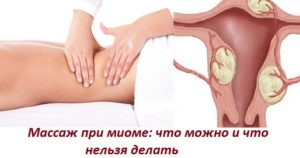 Что можно и чего нельзя делать при миоме матки