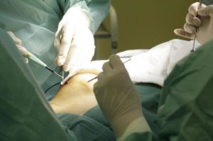 Операция по удалению рака молочной железы