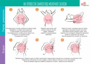 Как обследовать молочную железу самостоятельно