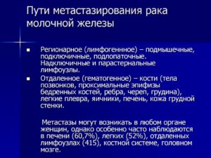 Метастазы при раке молочной железы