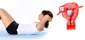 Какие физические упражнения можно делать при миоме матки
