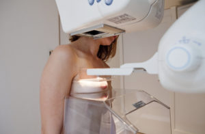 Как делается маммография молочных желез
