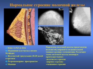 В молочных железах много железистой ткани