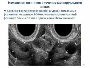 Фолликул в яичнике норма