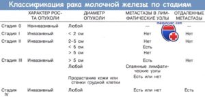 Стадии рака молочной железы классификация