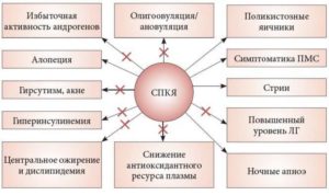 Синдром поликистозных яичников спкя