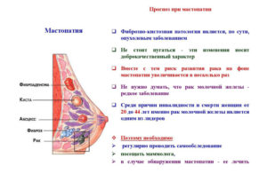 Фиброзно кистозная болезнь молочной железы что это