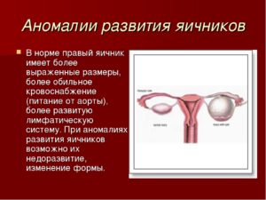 Пороки развития яичников