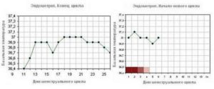 Базальная температура при эндометриозе