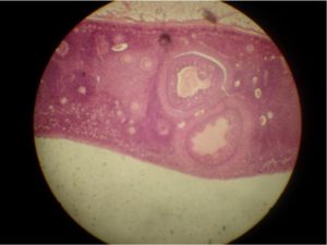 Гистология яичника